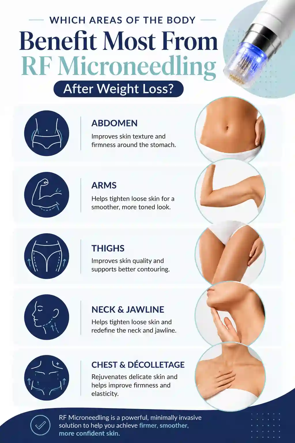 Which Areas of the Body Benefit Most From RF Microneedling After Weight Loss Waltham's Cross